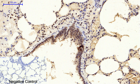 14 - JNK1/2/3 (phospho Tyr185) Polyclonal Antibody AP67775