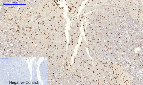 14 - JNK1/2/3 (phospho Tyr185) Polyclonal Antibody AP67775