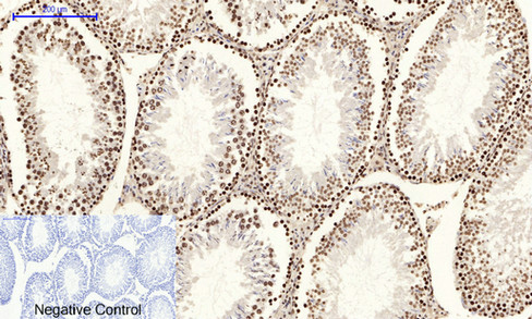 14 - JNK1/2/3 (phospho Tyr185) Polyclonal Antibody AP67775