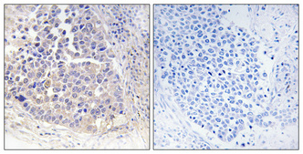 1 - ARF4 Polyclonal Antibody AP68491