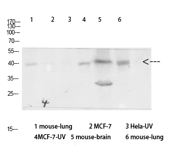 1 - Arrestin-β-1 Polyclonal Antibody AP68526