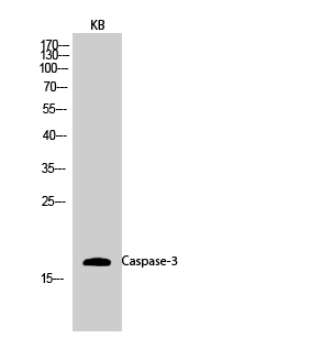1 - Caspase-3 Polyclonal Antibody AP68839