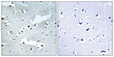 1 - Cdc40 Polyclonal Antibody AP68990