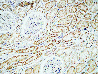 14 - Crystallin-αB Polyclonal Antibody AP69308