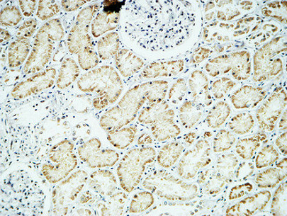 14 - Crystallin-αB Polyclonal Antibody AP69308