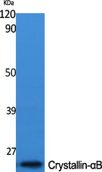 1 - Crystallin-αB Polyclonal Antibody AP69308