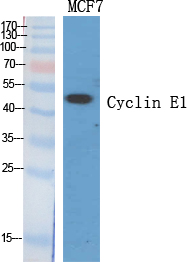 1 - Cyclin E1 Polyclonal Antibody AP69359