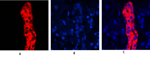 1 - Cytokeratin 19 Polyclonal Antibody AP69452