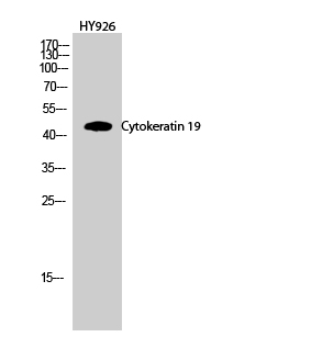 1 - Cytokeratin 19 Polyclonal Antibody AP69452