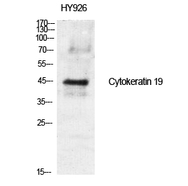 1 - Cytokeratin 19 Polyclonal Antibody AP69452