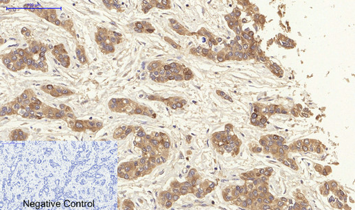 14 - Cytokeratin 19 Polyclonal Antibody AP69452