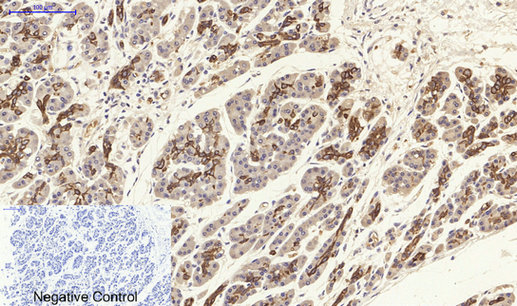 14 - Cytokeratin 19 Polyclonal Antibody AP69452