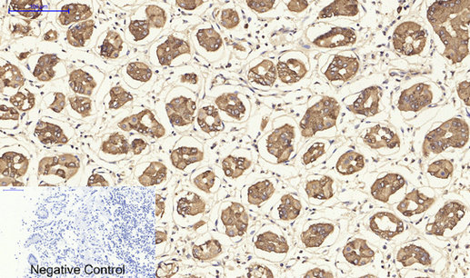 14 - Cytokeratin 19 Polyclonal Antibody AP69452