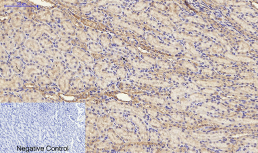 14 - Cytokeratin 19 Polyclonal Antibody AP69452