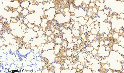 14 - Cytokeratin 19 Polyclonal Antibody AP69452