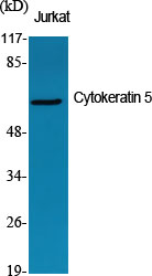1 - Cytokeratin 5 Polyclonal Antibody AP69454
