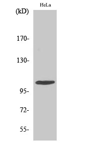 1 - eEF2K Polyclonal Antibody AP69657