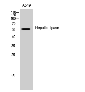 1 - Hepatic Lipase Polyclonal Antibody AP70309