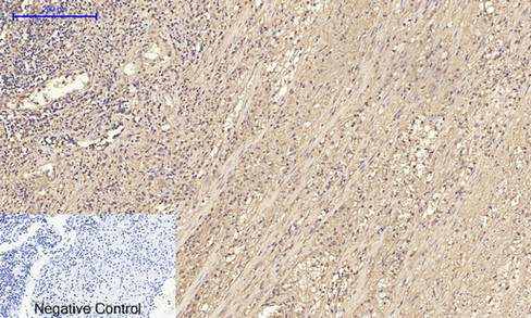 14 - IRS-1 Polyclonal Antibody AP70587