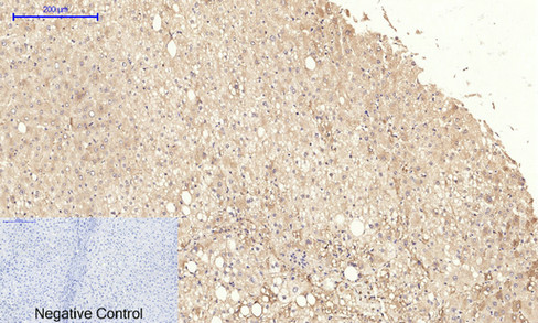 14 - IRS-1 Polyclonal Antibody AP70587