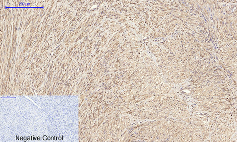 14 - IRS-1 Polyclonal Antibody AP70587