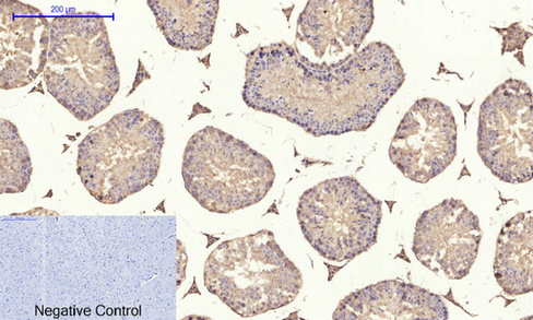 14 - IRS-1 Polyclonal Antibody AP70587