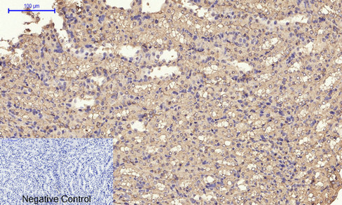 14 - IRS-1 Polyclonal Antibody AP70587