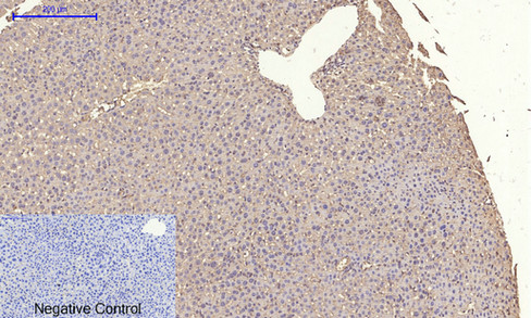 14 - IRS-1 Polyclonal Antibody AP70587