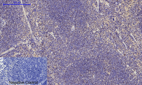 14 - IRS-1 Polyclonal Antibody AP70587