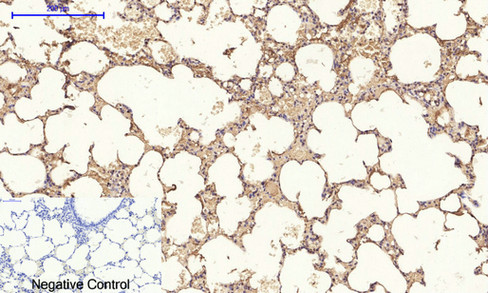 14 - IRS-1 Polyclonal Antibody AP70587