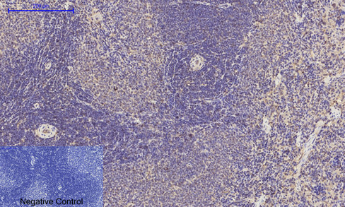 14 - IRS-1 Polyclonal Antibody AP70587