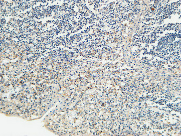 3 - KiSS-1R Polyclonal Antibody AP70663