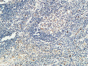 14 - KiSS-1R Polyclonal Antibody AP70663