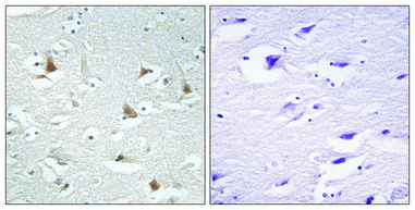 1 - Mlx Polyclonal Antibody AP70974