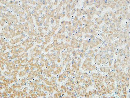 14 - Myogenin Polyclonal Antibody AP71127
