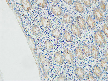 14 - Myogenin Polyclonal Antibody AP71127