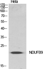 1 - NDUFB9 Polyclonal Antibody AP71197