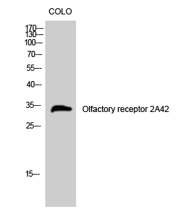 1 - Olfactory receptor 2A42 Polyclonal Antibody AP71473