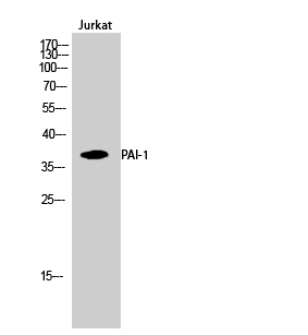 1 - PAI-1 Polyclonal Antibody AP71752