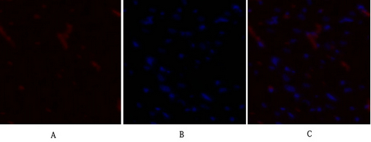 3 - PDK1 Polyclonal Antibody AP71828