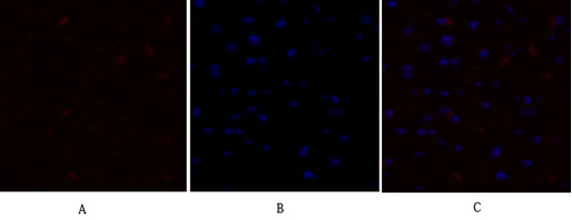 14 - PDK1 Polyclonal Antibody AP71828