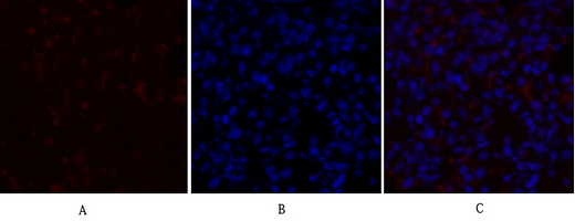 14 - PDK1 Polyclonal Antibody AP71828