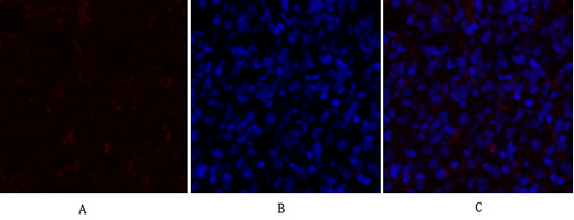 14 - PDK1 Polyclonal Antibody AP71828