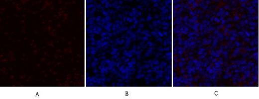 14 - PDK1 Polyclonal Antibody AP71828