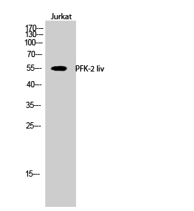 1 - PFK-2 liv Polyclonal Antibody AP71866