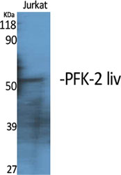 1 - PFK-2 liv Polyclonal Antibody AP71866