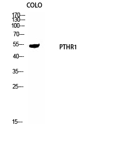 1 - PTH/PTHrP-R Polyclonal Antibody AP72081