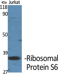 1 - Ribosomal Protein S6 Polyclonal Antibody AP72322