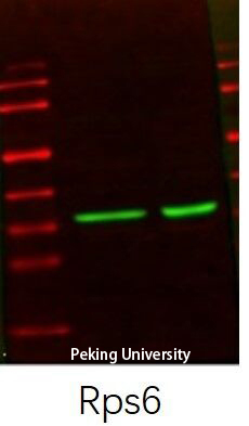 1 - Ribosomal Protein S6 Polyclonal Antibody AP72322