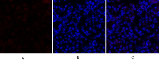 14 - SOCS-1 Polyclonal Antibody AP72545